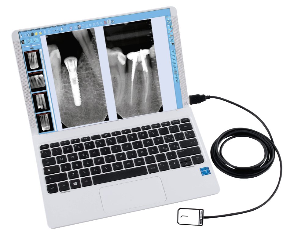 Castellini X-VS HD RVG sensör ve yazılım